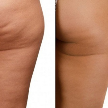 Тамара Леонова, Одесса Фото - 6