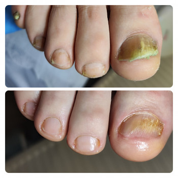 Анастасія Сухина, Ірпінь Фото - 8