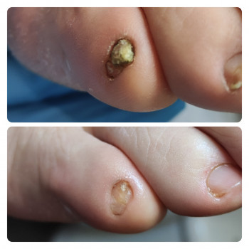 Анастасія Сухина, Ірпінь Фото - 9