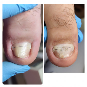 Анастасія Сухина, Ірпінь Фото - 11