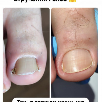 Анастасія Сухина, Ірпінь Фото - 13