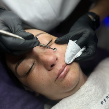 Механична чистка обличчя -900грн.
  