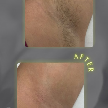 Аліна Маєвська, Одеса Фото - 6