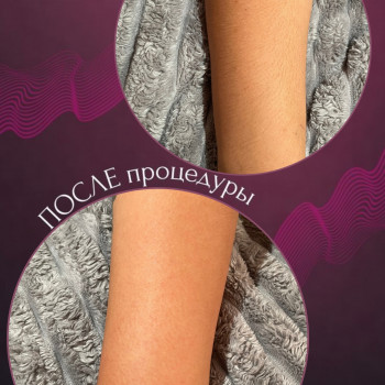 Восковая депиляция
                    Мастер депиляции  Одесса