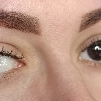 Нарощення класика