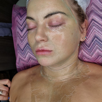 Ферментотерапия с использованием LED лампы. Экзосомальная ферментотерапия.
                    Косметолог-эстетист Влада Харьков