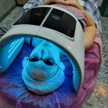 Ферментотерапия с использованием LED лампы. Экзосомальная ферментотерапия.
                    Косметолог-эстетист Влада Харьков