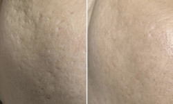  Косметолог Тетяна Александрия