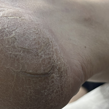 Ірина Абраменко, Кременчуг Фото - 37