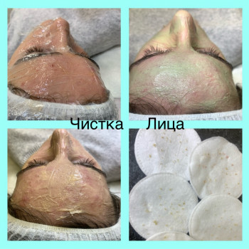 Чистка обличчя механічна