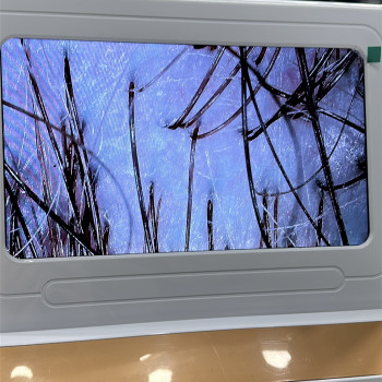 Після пілінгу