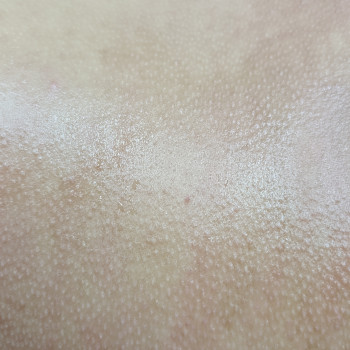 Іванна Пронів, Ужгород Фото - 8