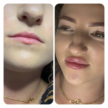 Be Beautiful, Ковель Фото - 5