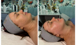 Масаж обличчя Косметолог Татьяна Киев