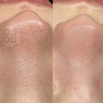 Вікторія Громяк, Ужгород Фото - 2