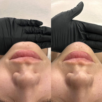 Оля Скульська, Тернополь Фото - 4