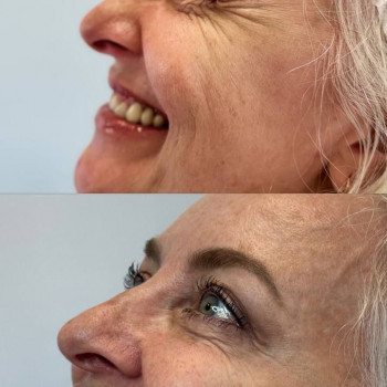 Оля Скульська, Тернополь Фото - 6