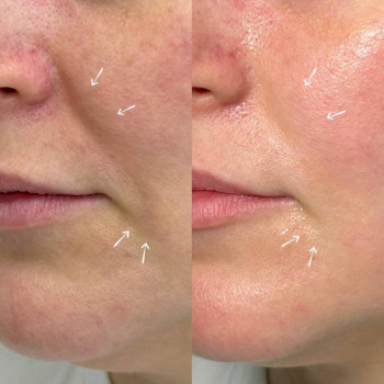 Оля Скульська, Тернополь Фото - 7