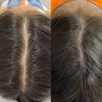 Оля Скульська, Тернополь Фото - 8