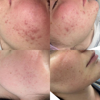 Оля Скульська, Тернополь Фото - 9