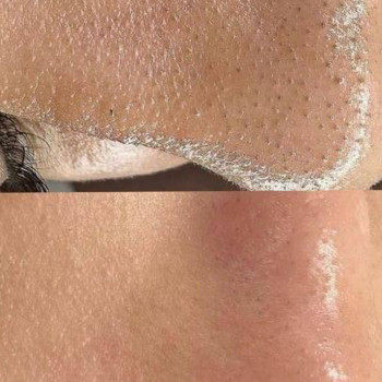 Оля Скульська, Тернополь Фото - 12