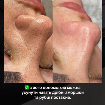 Оля Скульська, Тернополь Фото - 15