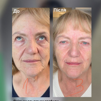 Оля Скульська, Тернополь Фото - 16