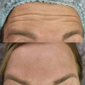 Оля Скульська, Тернополь Фото - 17