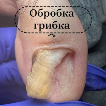 Алина Михалева, Нетешин Фото - 5