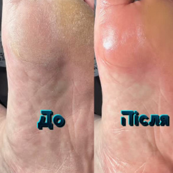 Алина Михалева, Нетешин Фото - 6