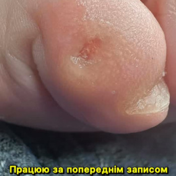 Алина Михалева, Нетешин Фото - 7