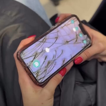 ТРИХОЛОГІЧНИЙ КОМПЛЕКС "ПРОТИ ЛУПИ"
                    Салон краси My Dream Черкаси