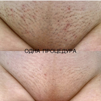 Фото з портфоліо салону INTA studio (нігтьова студія, Дніпро)