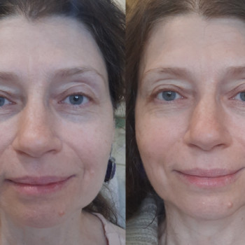 Наталья Кириченко, Днепр Фото - 5