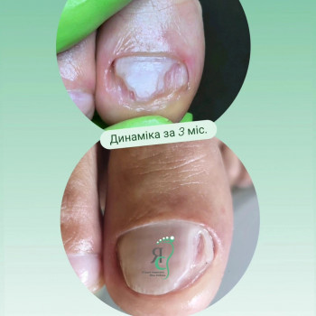 Яна Соболь, Дніпро Фото - 5