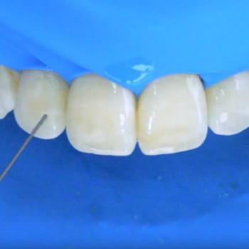 Назарий Гелей, Ужгород Фото - 1