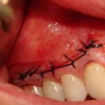 Назарий Гелей, Ужгород Фото - 2