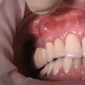 Назарий Гелей, Ужгород Фото - 3