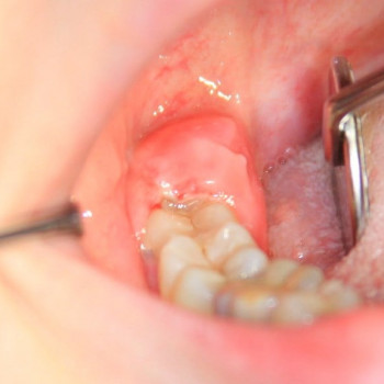 Назарий Гелей, Ужгород Фото - 4