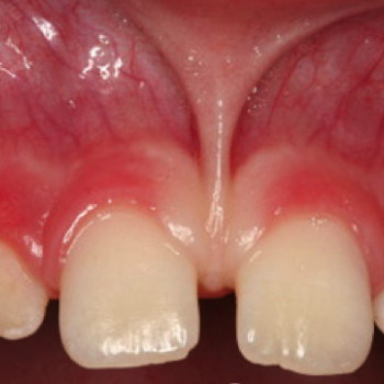 Назарий Гелей, Ужгород Фото - 5