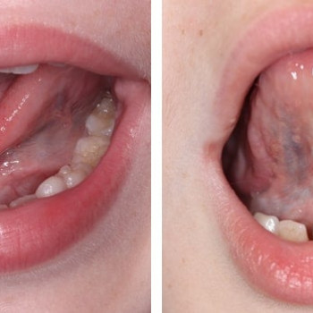 Назарий Гелей, Ужгород Фото - 6