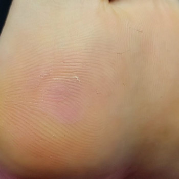 Инна Черноус, Умань Фото - 5