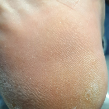 Людмила Смалько, Київ Фото - 2