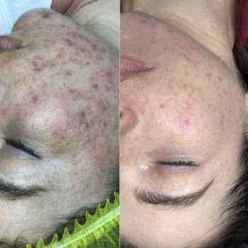 Світла Стасишина, Киев Фото - 11