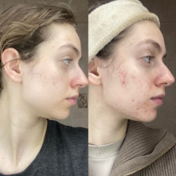 Світла Стасишина, Киев Фото - 9