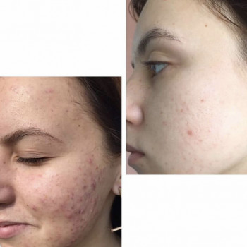 Світла Стасишина, Киев Фото - 4