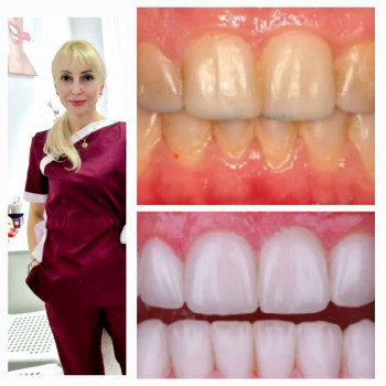 Мілена Лагута, Київ Фото - 6