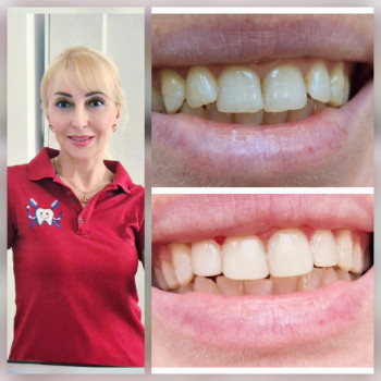 Мілена Лагута, Київ Фото - 1