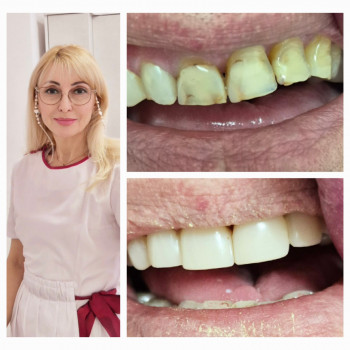 Мілена Лагута, Київ Фото - 4