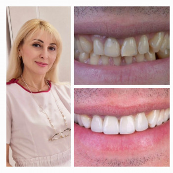 Мілена Лагута, Київ Фото - 5